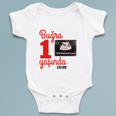 Ultrason fotoğraflı isme özel yaş kutlamalı bebek zıbın - 